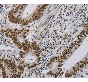 Immunohistochemistry - ZMAT3 Antibody from Signalway Antibody (36675) - Antibodies.com
