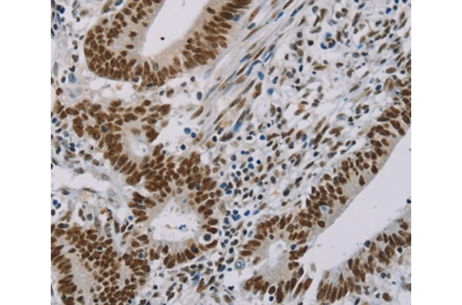 Immunohistochemistry - ZMAT3 Antibody from Signalway Antibody (36675) - Antibodies.com