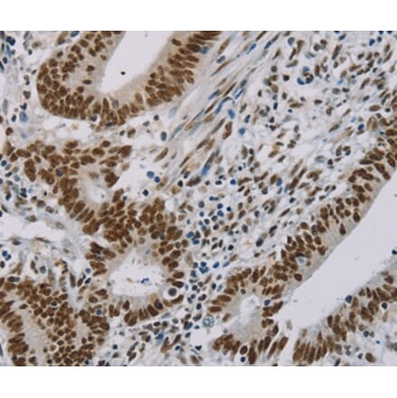 Immunohistochemistry - ZMAT3 Antibody from Signalway Antibody (36675) - Antibodies.com