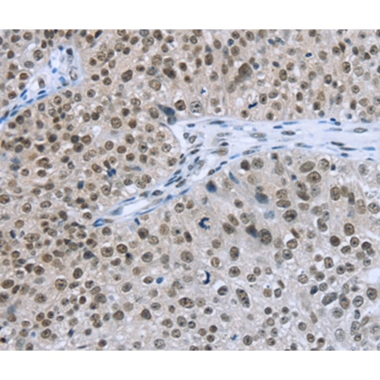 Immunohistochemistry - ZMAT3 Antibody from Signalway Antibody (36675) - Antibodies.com