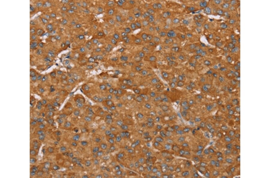 Immunohistochemistry - PAGE5 Antibody from Signalway Antibody (36676) - Antibodies.com