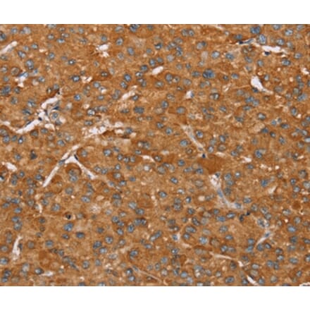 Immunohistochemistry - PAGE5 Antibody from Signalway Antibody (36676) - Antibodies.com