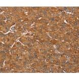 Immunohistochemistry - PAGE5 Antibody from Signalway Antibody (36676) - Antibodies.com