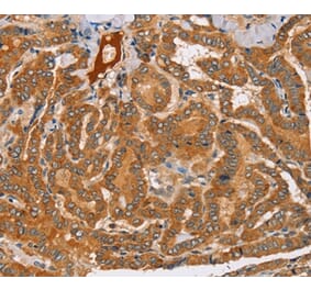 Immunohistochemistry - PEA15 Antibody from Signalway Antibody (36689) - Antibodies.com
