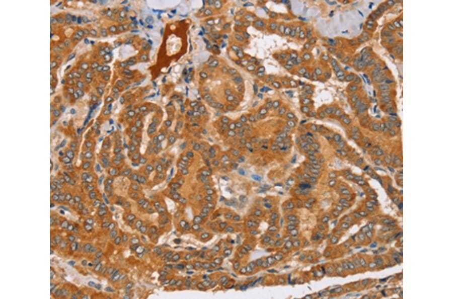 Immunohistochemistry - PEA15 Antibody from Signalway Antibody (36689) - Antibodies.com