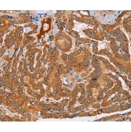 Immunohistochemistry - PEA15 Antibody from Signalway Antibody (36689) - Antibodies.com