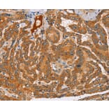 Immunohistochemistry - PEA15 Antibody from Signalway Antibody (36689) - Antibodies.com