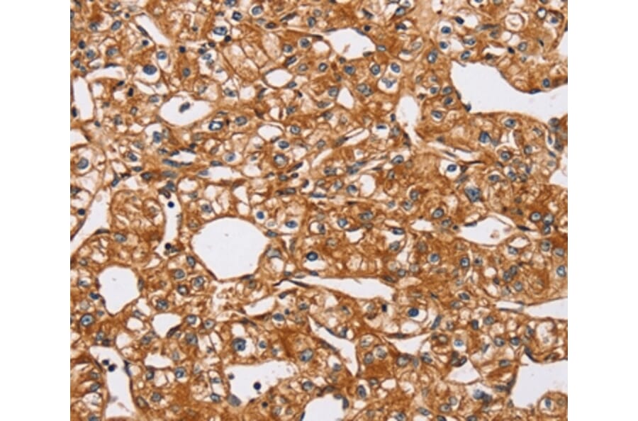 Immunohistochemistry - PEA15 Antibody from Signalway Antibody (36689) - Antibodies.com