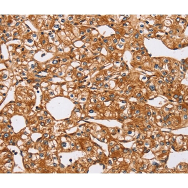 Immunohistochemistry - PEA15 Antibody from Signalway Antibody (36689) - Antibodies.com