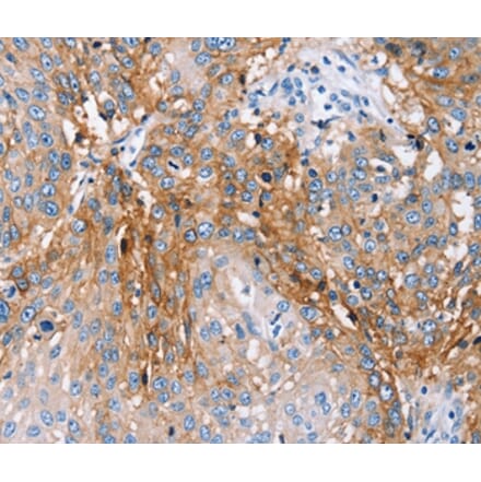 Immunohistochemistry - PLCZ1 Antibody from Signalway Antibody (36697) - Antibodies.com