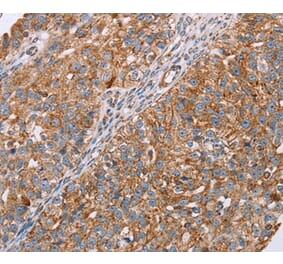 Immunohistochemistry - RMDN3 Antibody from Signalway Antibody (36705) - Antibodies.com