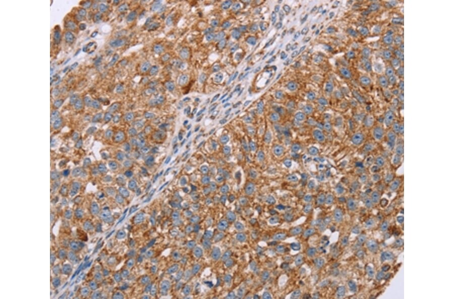 Immunohistochemistry - RMDN3 Antibody from Signalway Antibody (36705) - Antibodies.com