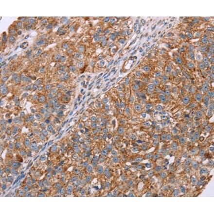 Immunohistochemistry - RMDN3 Antibody from Signalway Antibody (36705) - Antibodies.com