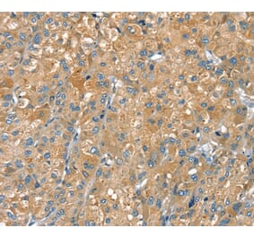 Immunohistochemistry - PTPRN Antibody from Signalway Antibody (36707) - Antibodies.com