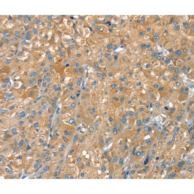 Immunohistochemistry - PTPRN Antibody from Signalway Antibody (36707) - Antibodies.com