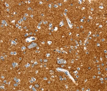 Immunohistochemical analysis of paraffin-embedded Human brain tissue using #36708 at dilution 1/20.