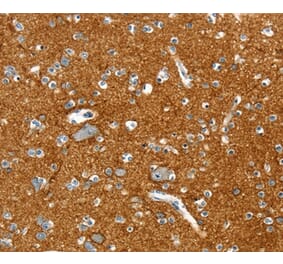 Immunohistochemistry - PTPN3 Antibody from Signalway Antibody (36708) - Antibodies.com