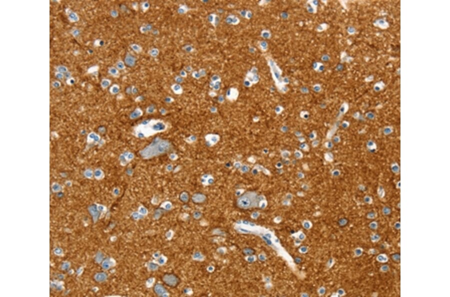 Immunohistochemistry - PTPN3 Antibody from Signalway Antibody (36708) - Antibodies.com