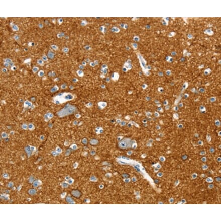 Immunohistochemistry - PTPN3 Antibody from Signalway Antibody (36708) - Antibodies.com