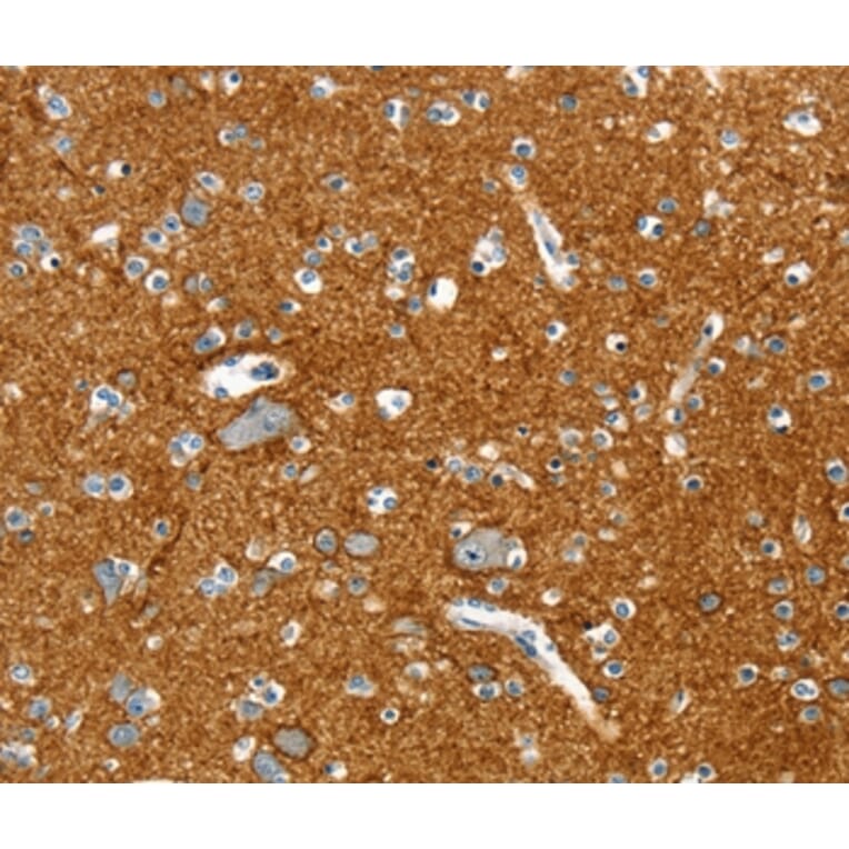 Immunohistochemistry - PTPN3 Antibody from Signalway Antibody (36708) - Antibodies.com