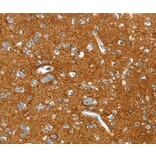 Immunohistochemistry - PTPN3 Antibody from Signalway Antibody (36708) - Antibodies.com