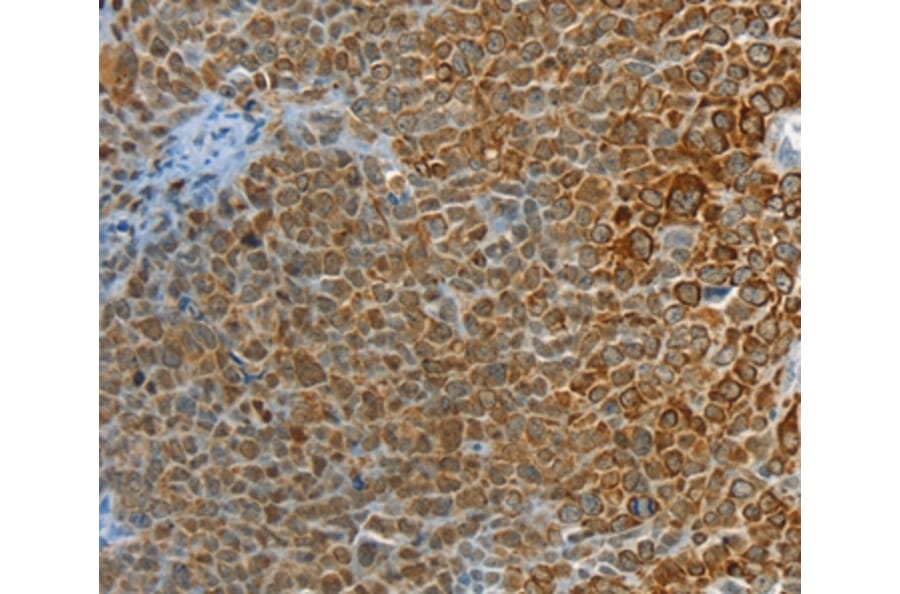 Immunohistochemistry - PTPN3 Antibody from Signalway Antibody (36708) - Antibodies.com