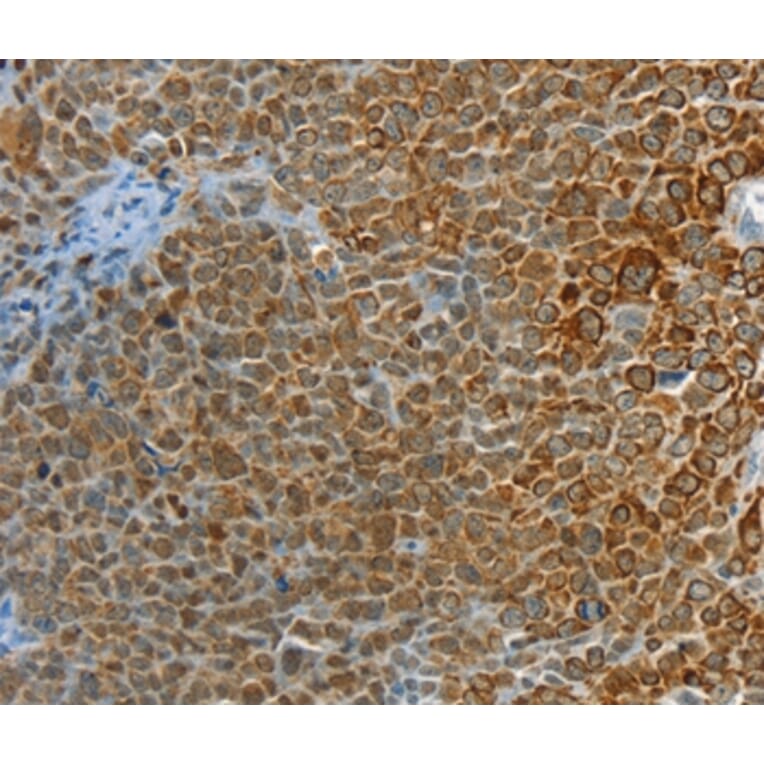 Immunohistochemistry - PTPN3 Antibody from Signalway Antibody (36708) - Antibodies.com