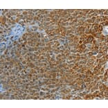 Immunohistochemistry - PTPN3 Antibody from Signalway Antibody (36708) - Antibodies.com
