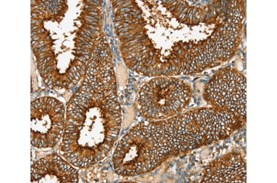Immunohistochemistry - RAB25 Antibody from Signalway Antibody (36711) - Antibodies.com
