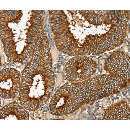 Immunohistochemistry - RAB25 Antibody from Signalway Antibody (36711) - Antibodies.com