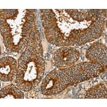 Immunohistochemistry - RAB25 Antibody from Signalway Antibody (36711) - Antibodies.com
