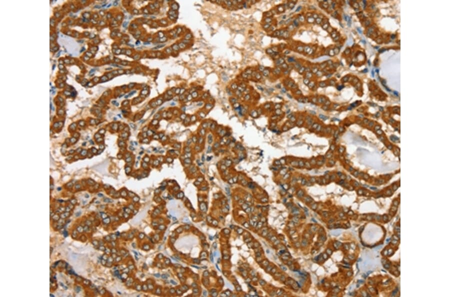 Immunohistochemistry - RAB25 Antibody from Signalway Antibody (36711) - Antibodies.com