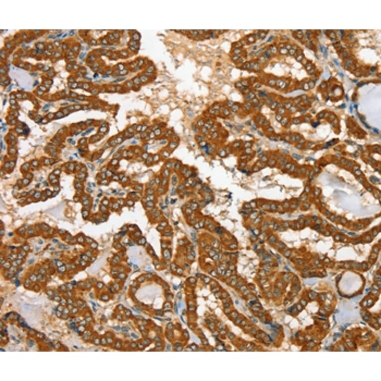 Immunohistochemistry - RAB25 Antibody from Signalway Antibody (36711) - Antibodies.com