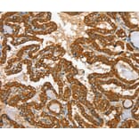 Immunohistochemistry - RAB25 Antibody from Signalway Antibody (36711) - Antibodies.com