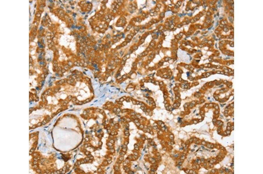 Immunohistochemistry - RAB2A Antibody from Signalway Antibody (36712) - Antibodies.com