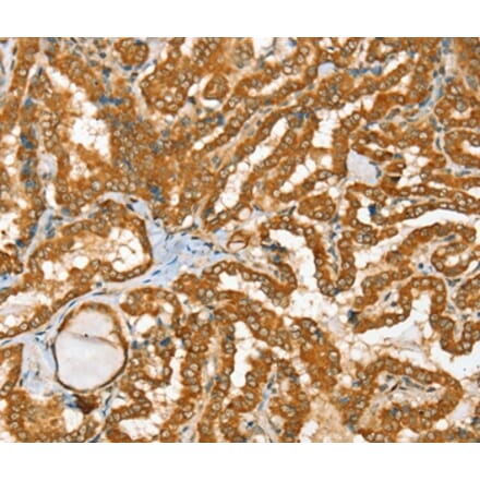 Immunohistochemistry - RAB2A Antibody from Signalway Antibody (36712) - Antibodies.com