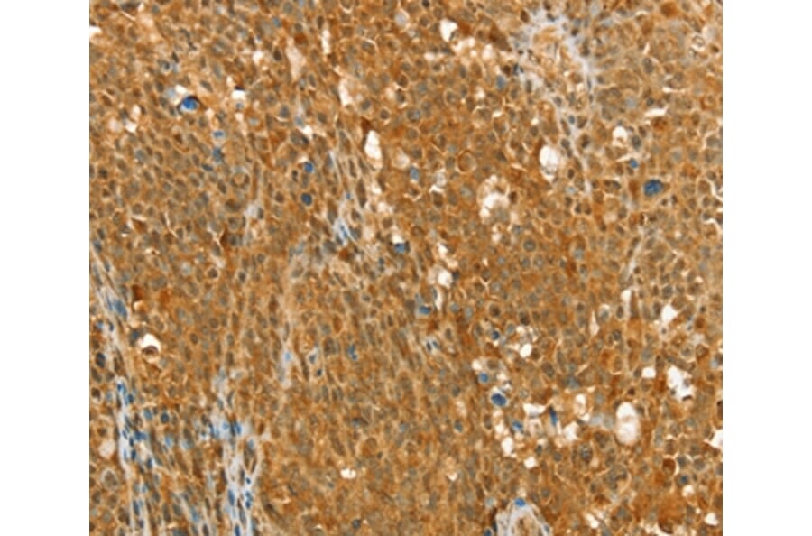 Immunohistochemistry - RAB2A Antibody from Signalway Antibody (36712) - Antibodies.com