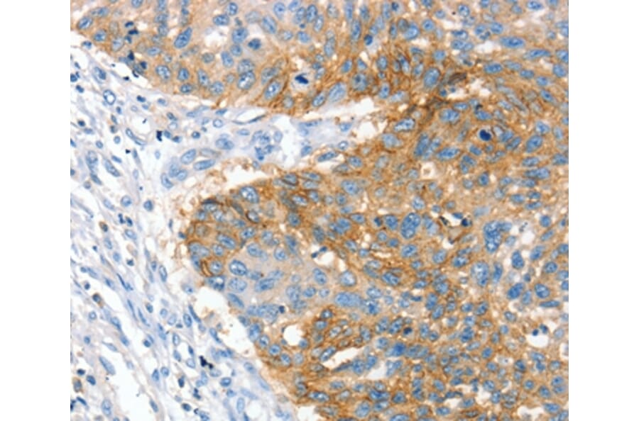 Immunohistochemistry - CRADD Antibody from Signalway Antibody (36713) - Antibodies.com