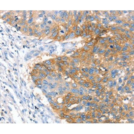 Immunohistochemistry - CRADD Antibody from Signalway Antibody (36713) - Antibodies.com