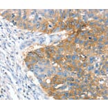 Immunohistochemistry - CRADD Antibody from Signalway Antibody (36713) - Antibodies.com
