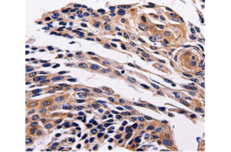 Immunohistochemistry - ADRB1 Antibody from Signalway Antibody (36730) - Antibodies.com