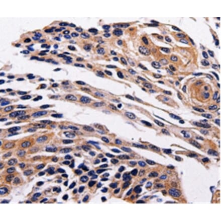 Immunohistochemistry - ADRB1 Antibody from Signalway Antibody (36730) - Antibodies.com
