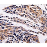 Immunohistochemistry - ADRB1 Antibody from Signalway Antibody (36730) - Antibodies.com