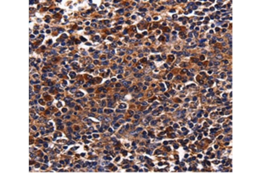 Immunohistochemistry - ADRB1 Antibody from Signalway Antibody (36730) - Antibodies.com