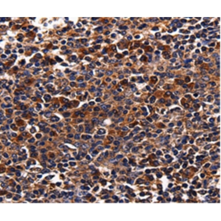 Immunohistochemistry - ADRB1 Antibody from Signalway Antibody (36730) - Antibodies.com