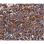 Immunohistochemistry - ADRB1 Antibody from Signalway Antibody (36730) - Antibodies.com