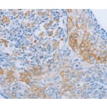 Immunohistochemistry - ADRB3 Antibody from Signalway Antibody (36731) - Antibodies.com