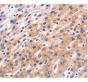 Immunohistochemistry - RAB39 Antibody from Signalway Antibody (36737) - Antibodies.com