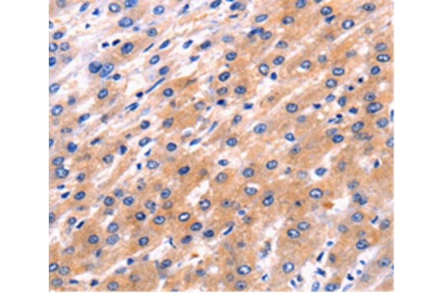 Immunohistochemistry - RAB39 Antibody from Signalway Antibody (36737) - Antibodies.com