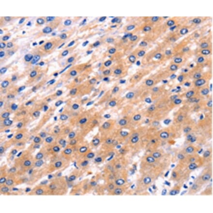 Immunohistochemistry - RAB39 Antibody from Signalway Antibody (36737) - Antibodies.com